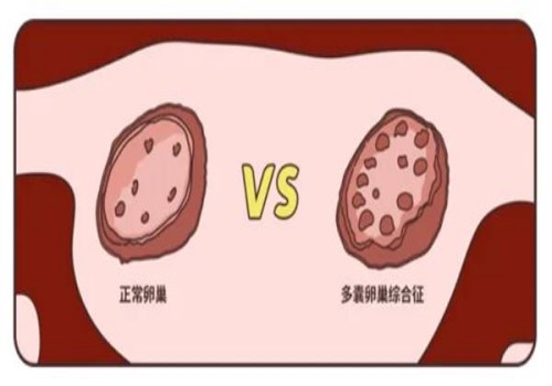 上海试管供精：﻿新生儿黄疸严重or不严重？主要看新生儿黄疸的数值是多少